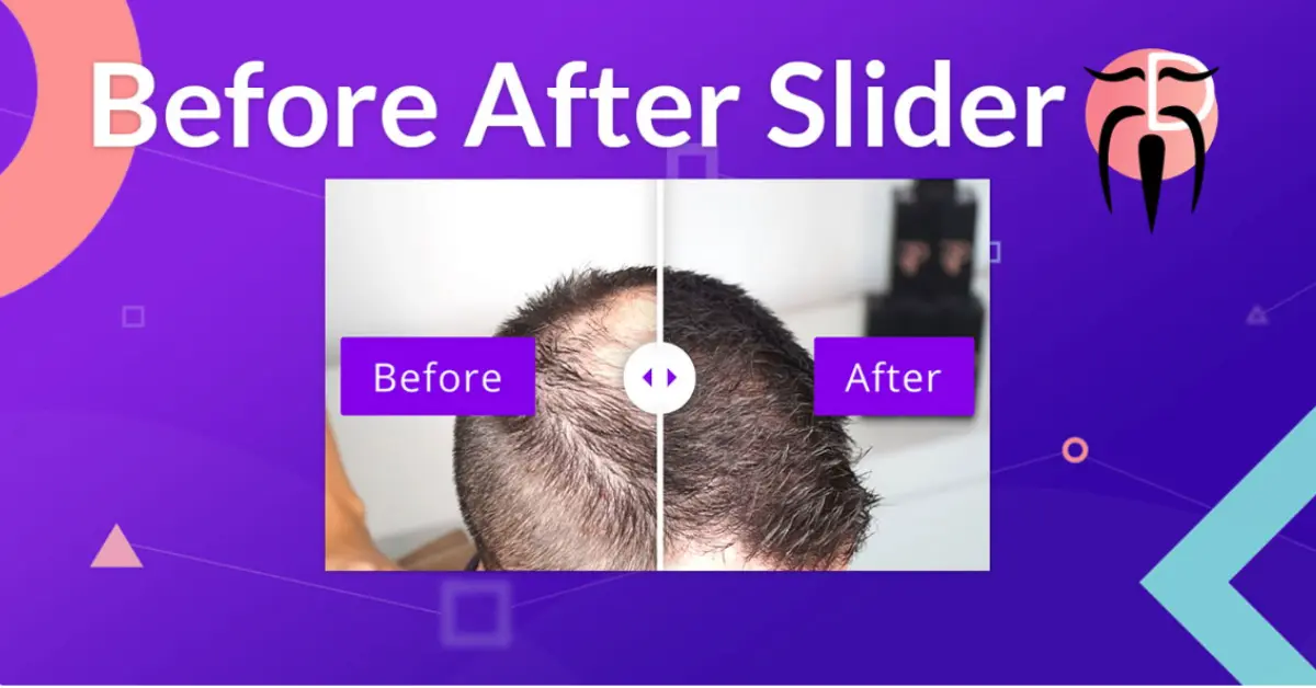 Before After Slider for Divi showing an image comparison slider with before and after labels